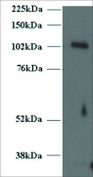 Anti-MUNC13-4/UNC13D, C-Terminal antibody produced in
