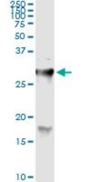Monoclonal Anti-HYAL1 antibody produced in