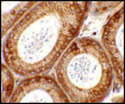 Anti-SPATA6 antibody produced in rabbit