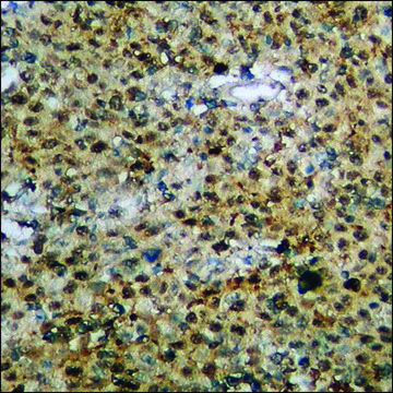 Anti-phospho-Interferon-? Receptor ? (pTyr???) antibody