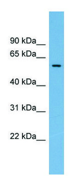 Anti-IFI44 antibody produced in rabbit