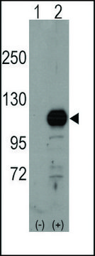 Anti-FRAT1 (center) antibody produced in