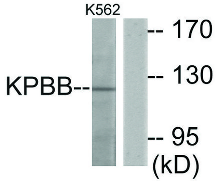 Anti-KPBB antibody produced in rabbit