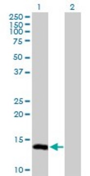 Anti-UBE2L6 antibody produced in rabbit