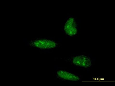 ANTI-ATOH1 antibody produced in mouse