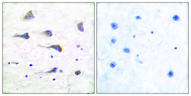 Anti-MGLUR6 antibody produced in rabbit