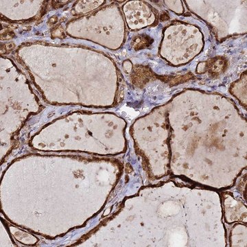 Anti-NUDT14 antibody produced in rabbit