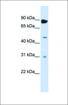 Anti-ADARB1 antibody produced in rabbit