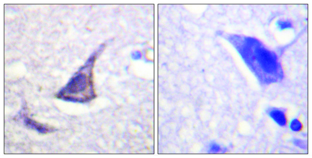 Anti-C/EBP-? antibody produced in rabbit