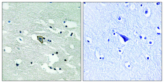 Anti-phospho-VEGFR1 (pTyr¹???) antibody produced in