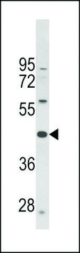 ANTI-PTAR1 (CENTER) antibody produced in