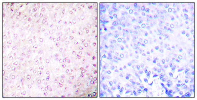 Anti-p300 antibody produced in rabbit