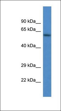 Anti-HPSE antibody produced in rabbit