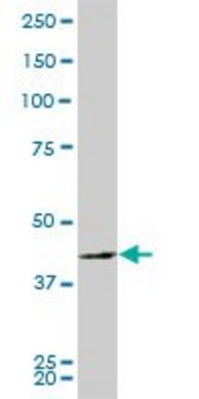 ANTI-PBK antibody produced in mouse