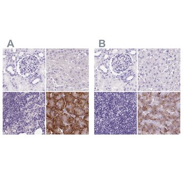 Anti-PDIA2 antibody produced in rabbit
