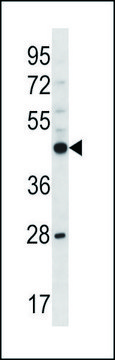ANTI-MOUSE PHKG2 (N-TERM) antibody produced