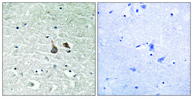 Anti-phospho-IRAK1 (pSer³??) antibody produced in