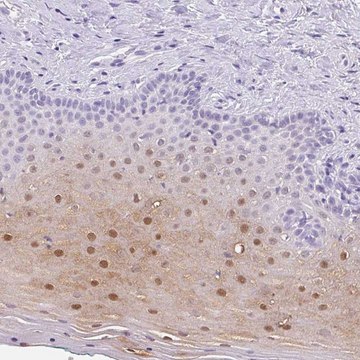 Anti-SERPINB4 antibody produced in rabbit