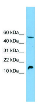 Anti-EPO antibody produced in rabbit