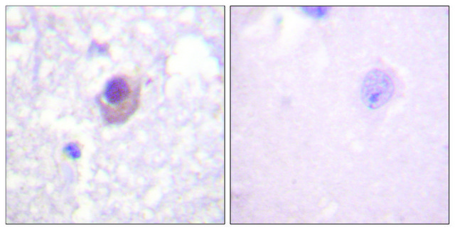 Anti-SGK antibody produced in rabbit