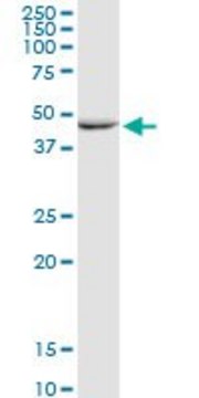 Anti-GALK2 antibody produced in rabbit