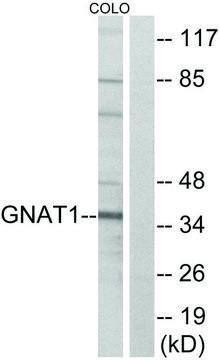Anti-GNAT1 antibody produced in rabbit