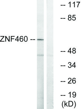 Anti-ZNF460 antibody produced in rabbit