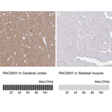 Anti-PACSIN1 antibody produced in rabbit