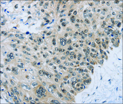 Anti-SLC16A4 antibody produced in rabbit