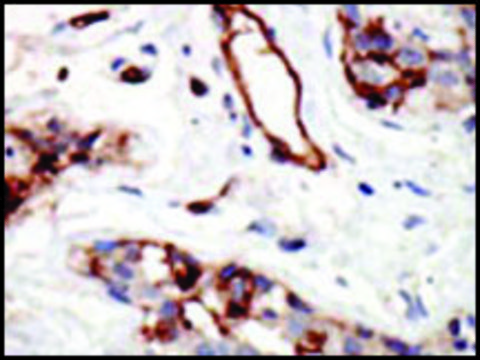 Anti-HRX (center) antibody produced in