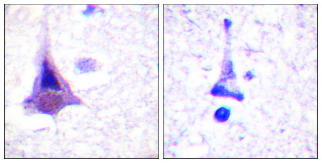 Anti-MYPT1 antibody produced in rabbit