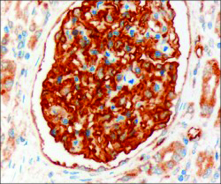 Anti-SLC9A3R2 Isoform A3 antibody produced