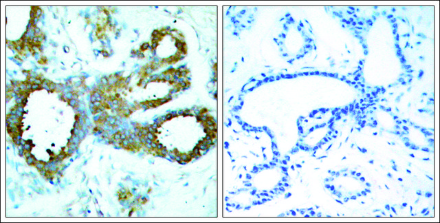 Anti-phospho-PAK1/PAK2/PAK3 (pThr?²³/pThr??²/pThr?²¹) antibody produced in