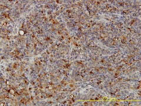 Monoclonal Anti-ACP2 antibody produced in