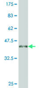 ANTI-ATOH1 antibody produced in mouse