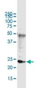 Monoclonal Anti-DDIT4L, (C-terminal) antibody produced