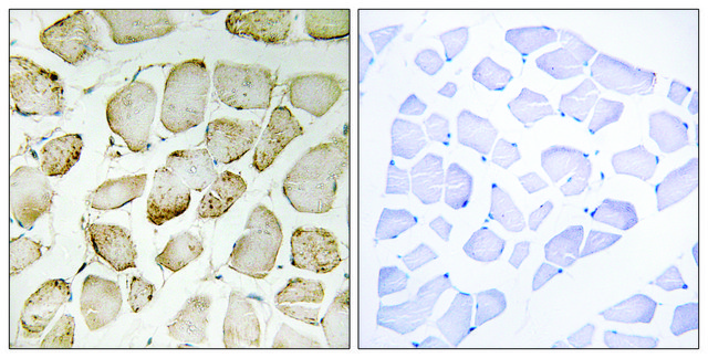 Anti-Arachidonate 5 Lipoxygenase antibody produced