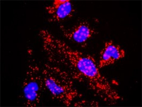 Anti-TBL1X antibody produced in rabbit