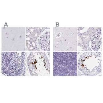 Anti-TEX44 antibody produced in rabbit