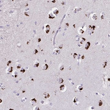Anti-GLTPD2 antibody produced in rabbit