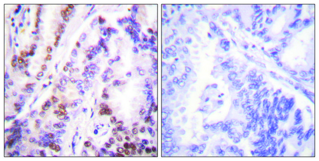 Anti-HDAC9 antibody produced in rabbit