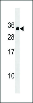 ANTI-PDCD10 (CENTER) antibody produced in