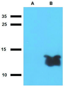 Anti-Tb7.7 (M. tuberculosis) antibody produced