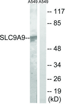 Anti-SLC9A9 antibody produced in rabbit
