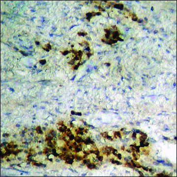 Anti-phospho-HDAC3 (pSer?²?) antibody produced in