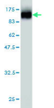 ANTI-TOP3B antibody produced in mouse