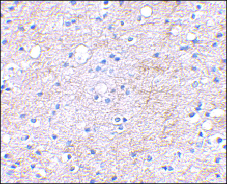 Anti-LGI1 (ab1) antibody produced in