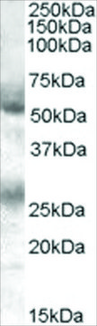 Anti-FLVCR antibody produced in goat