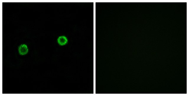 Anti-ACOT4 antibody produced in rabbit