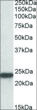 Anti-SOD2 antibody produced in goat